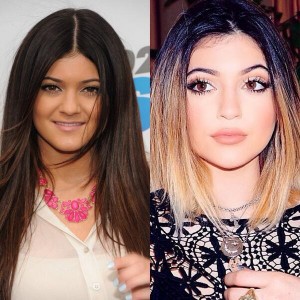 Several publications report that Kylie Jenner has had several operations from September 2009 to April, 2014